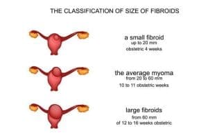 fibroids awareness image