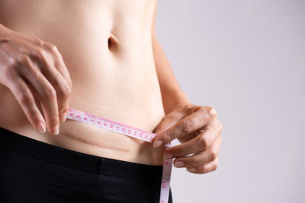 measure scar