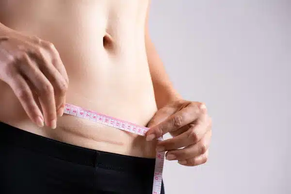 measure scar