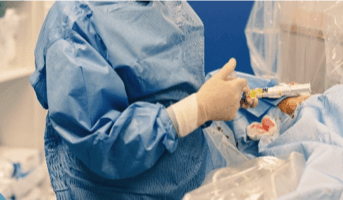 should you remove fibroids