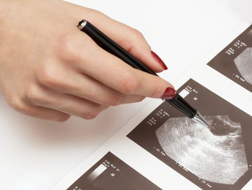 ultrasound scans