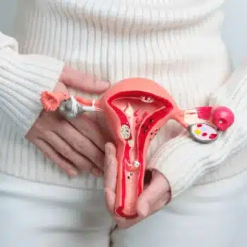 Fibroids
